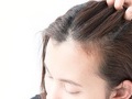 봄마다 반복되는 두피 비듬·얼굴 홍조, '지루성피부염' 방치하면 탈모까지